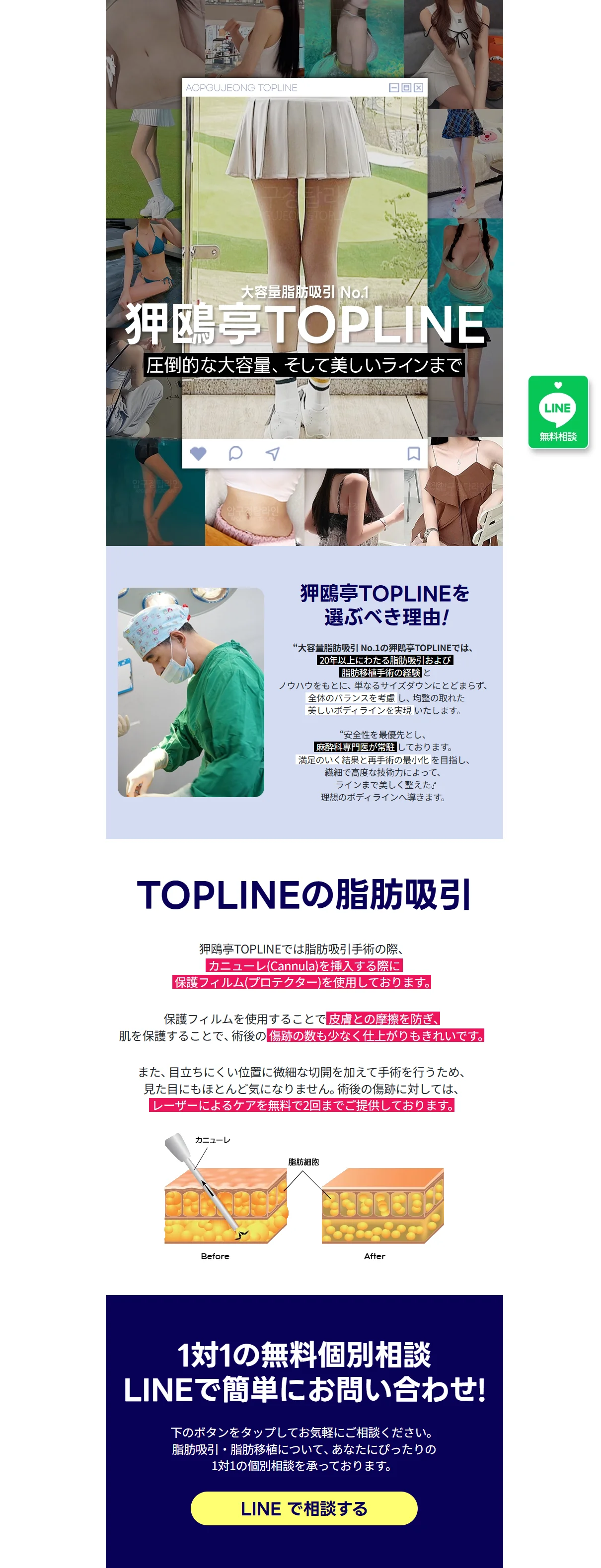 일본 성형외과 이벤트 페이지