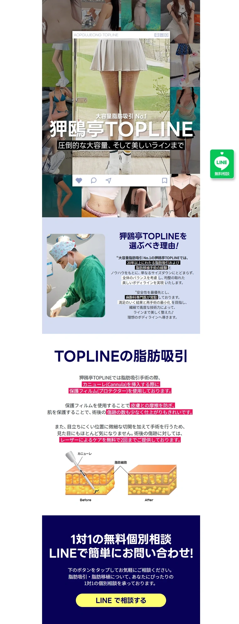 일본 성형외과 이벤트 페이지